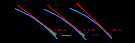 LZA